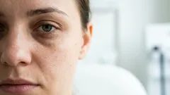 Så tar du bort mörka ringar under ögonen utan dyra krämer – 7 enkla regler från en expert