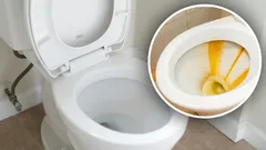Fleråriga beläggningar försvann från toaletten: hemblandning med tre ingredienser gjorde susen